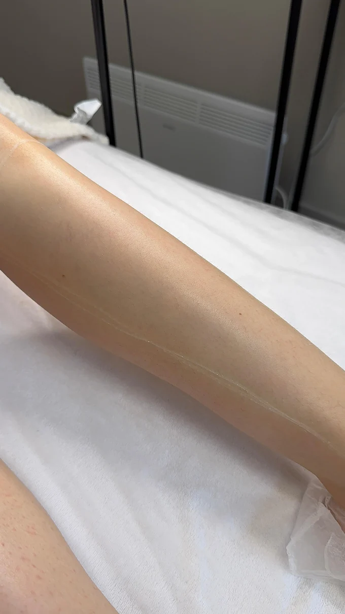 Достигните идеальной гладкости: два пути к эстетике тела