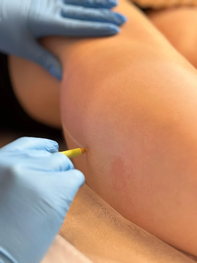 Достигните идеальной гладкости: два пути к эстетике тела